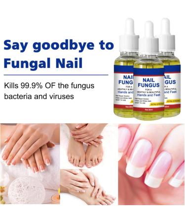 Nail Fungal Treatment Toenail Treatment Extra Strong Nail Repair Set Fingernail Toenail Care Fix Renew Damaged Broken Anti Fungus Nail Repair - Buy Online on GoSupps.com