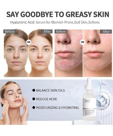 Hyaluronic Acid 2%+B5 Face Serum Hyalu B5 Serum Hydrating Serum Hyaluronic Acid Serum for Face Hyaluronic Acid for Face Hydrated Anti Aging Serum for Face Brightening Serum to Plump and Smooth Skin - Buy Online on GoSupps.com