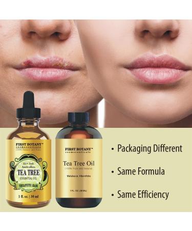 High Terpinen Australian Tea Tree Oil - Combat Acne, Toenail Problems, Dandruff - 1 fl oz - Buy Online on GoSupps.com