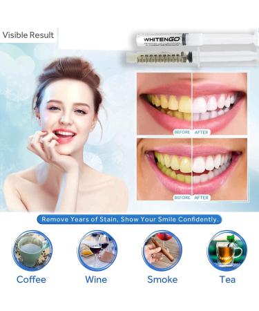 Smile Sciences Teeth Whitening Gel Refill Syringe - Fast Results, Remove Stains, Peppermint Flavor - Buy Online on GoSupps.com