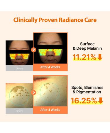 DERMAFIRM Peptology Niacinamide Vitamin C Ampoule - GLASS SKIN with 15% Niacinamide Brightening Ampoule with Glutathione for Dark Spot Correction & Radiance Boost - Korean Skincare 30ml - Buy Online on GoSupps.com