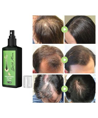 YUECI Nutrient Spray for Hair Growth - Hair Growth Serum & Anti-Hair Loss Treatment - Quick Thickening & Growth Solution (1ml) - Green - Buy Online on GoSupps.com