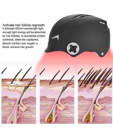 Premium Hair Growth Helmet - Alopecia Therapy with Advanced Technology for Hair Loss Prevention - Buy Online on GoSupps.com