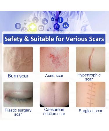 Scar Away Silicone Scar Sheets - Transparent Gel Tape for C-Section, Keloids, Burn & Acne - Medical Grade Removal Strips (1.6 x 120) - Buy Online on GoSupps.com
