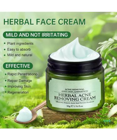 ARCHIDATE Acne Removing Face Cream Natural Formula Herbal Acne Cream for Oily Prone Combination Skin Reduce Pimples Blemishes Blackheads Clean and Purify Pores Control Oil Soothe & Calm Skin - Buy Online on GoSupps.com