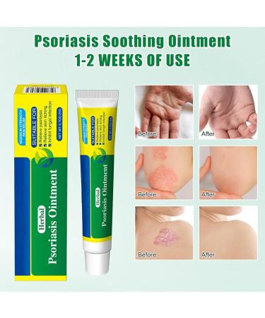 Neyeau Natural Organic Chinese Herbal Cream Skin Cream Soothing Ointment Dermatitis Cream - Relieve Itching for Dry Skin Rough Skin Peeling Moisturizing Skincare External Use - Buy Online on GoSupps.com