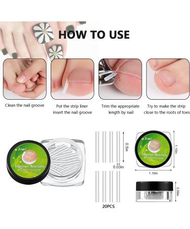 Ingrown Toenail Tool Kit - Professional Podiatrist Nail Clippers Set for Effective Treatment - Ideal for Seniors, Arthritis, Diabetic - Thick Toenail Correction - Buy Online on GoSupps.com