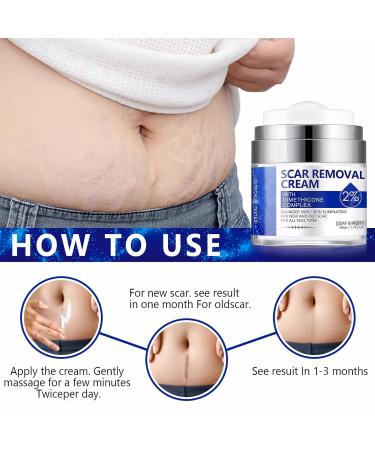 50ml Skin Repair Stretch Mark & Scar Removal Cream - Effective Surgery, Injury & C-Section Scar Lightening Treatment & Toenail Clippers Removal Solution - Buy Online on GoSupps.com