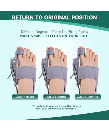 Ergonomic Bunion Corrector for Men & Women | Adjustable Orthopedic Toe Straightener with Comfort Silicone Pad | Effective Big Toe Bunion Relief (Grey - Buy Online on GoSupps.com