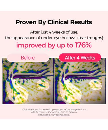 Cyano Pink Spicule Cream - Reduce Dark Circles Puffiness & Fine Lines | Calcium & Vitamin B12 1.69 fl. oz - Buy Online on GoSupps.com