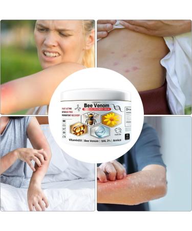 Skin Repair Cream AntiItch Ointment Relieve Itchy Skin Cream 30g AntiItch Relieving Lotion Moisturizing Skin Care Cream to Relieve Itching and Redness on Skin - Buy Online on GoSupps.com