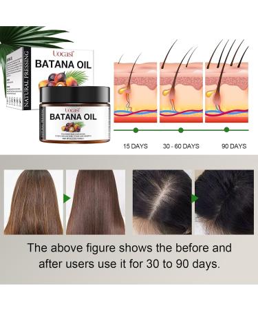 Uocasi Black Batana Oil - 100% Pure Organic Hair Growth Treatment Prevents Dry Hair & Split Ends (4.2 OZ - Buy Online on GoSupps.com