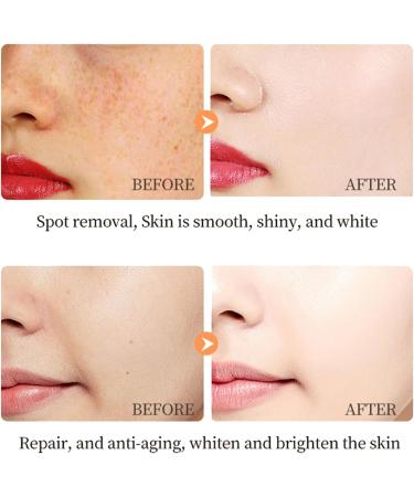 Face Serum for Women - 23% Vitamin C Serum For Face - Face Serum for Removes Dark Spots - Hydrating Hyaluronic Acid Serum - Anti Aging and Fade Fine Lines 30ml - Buy Online on GoSupps.com