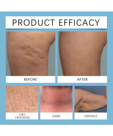 Face Tightening Cream Anti-Wrink-le Cream Rapid Wrink-le Repair Cream 80g Firming Cream For Moisturizes And Makes Skin Fair And Smooth - Buy Online on GoSupps.com