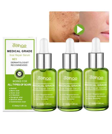 Goopgen Advanced Scar Repair Serum Goopgen Medical Grade Scar Repair Serum Goopgen Scar Repair Scar Remove Medical Grade Scar Spray Advanced Scar Spray for All Types of Scar (90ml)