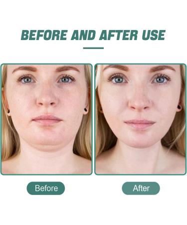 Reusable Double Chin Strap Tightening Tape - V Line Face Slimmer Shaper for Women and Men Comes with A Storage Bag(Green) - Buy Online on GoSupps.com