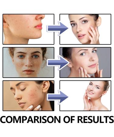 Vitamin C Suspension 23% + HA Spheres 2% Face Cream Vitamin C Face Cream with Hyaluronic Acid Face Moisturiser for Brighten Skin Tone & Blemish Anti Aging Face Cream Skin Lightening & Hydrating Cream - Buy Online on GoSupps.com