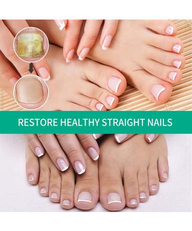 Kerassentials Toenail Fungus Treatment - Healthy Skin, Hair & Nails - 2PC Pack of 1 Fl Oz - Buy Online on GoSupps.com