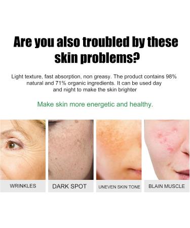 Age Spot Remover for Face Dark Spot Remover for Face & Body Spot Cream Dark Spot Corrector Freckle Remover Cream Dark Spot Correcting Glow Serum Dark Spots Remover Dark Spot Corrector Cream 20 g - Buy Online on GoSupps.com