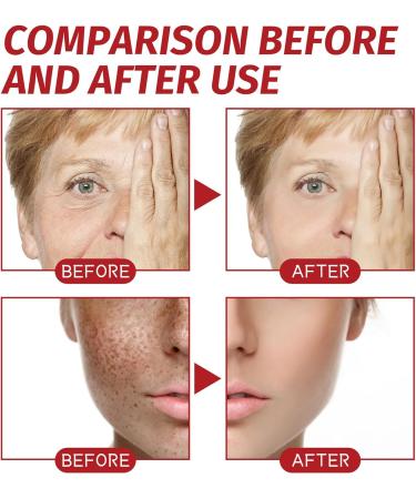 Dragons Blood Easy Cream Retinol Placenta Dragon Blood Cream Dragon Blood Cream for Anti Aging Dragon Blood Cream Day & Night Cream Anti Wrinkle Face Cream Absorb Quickly - Buy Online on GoSupps.com