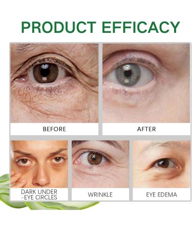 Aloe Vera Eye Cream Aloe Vera Under Eye Cream Eye Cream Anti Aging Eye Cream for Dark Circles and Puffy Eyes Eye Bags Remover Dark Eyes Circle Treatment Reduce Fine Lines Moisturising Soothing - Buy Online on GoSupps.com