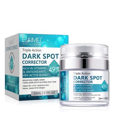 Dark Spot Remover for Face Body Dark Spot Corrector Cream Melasma Treatment for Face Sun Spot Remover for Face Freckle Remover Cream dark spot remover for face cream