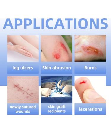 Dr. Med Silver Calcium Alginate Wound Dressing 4''x4'' Patches - High Absorbency Alginate Wound Bandage - Non-Adhesive Gauze - Painless Removal - 10 Individual Packs (10 PCS/Box) - Buy Online on GoSupps.com