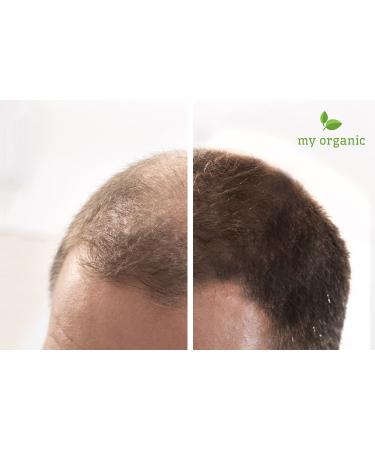 Buy My Organic Hair Defection Spout - 100% Natural & Vegan Hair Treatment - 26g for Immediate Light Blonde Effect - Buy Online on GoSupps.com