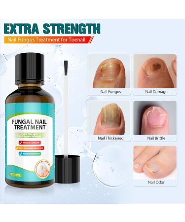 Nail Fungus Treatment Quick Intensive Agent Against Nail Polish Against Nail Fungus for Fingernails and Toenails Tea Tree Oil - Cyan Blue - 1 Fl Oz - Buy Online on GoSupps.com