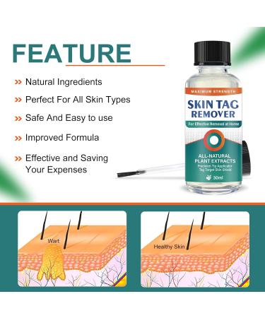 Skin-Tag-Remover Kit Remover for Verruca-Treatment - 30ml - Buy Online on GoSupps.com