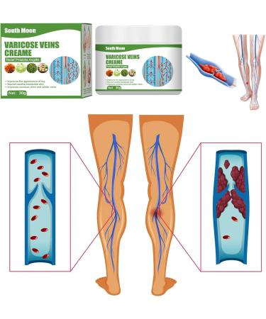  Katutude Repair cream for varicose veins and spider veins. Varicose vein cream to relieve varicose veins and spider veins. - Buy Online on GoSupps.com