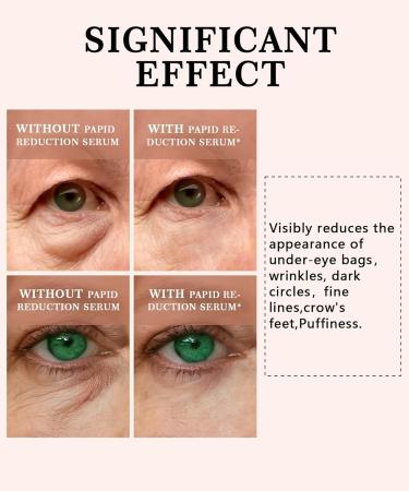 2 PCS Temporary Eye Tightener - Perfection Firming Lift Cream Instant Eye Serum for Dark Circles & Puffiness Daily Wrinkle Cream Anti Aging Skin Care Treatment Women and Men 1 oz - Buy Online on GoSupps.com