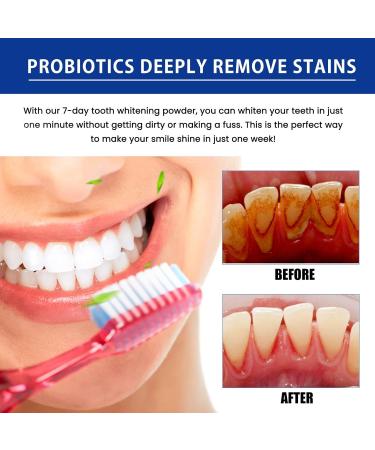 Miyanxi Probiotic Tooth Powder - Effective Teeth Whitening Powder for White Teeth - 50g - Buy Online on GoSupps.com