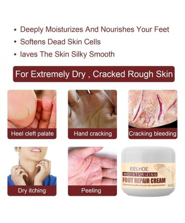 100% Natural Foot Care Cream for Dry Skin & Cracked Heels | Glycerin Infused | Soothes & Refreshes Tired Feet - Buy Online on GoSupps.com