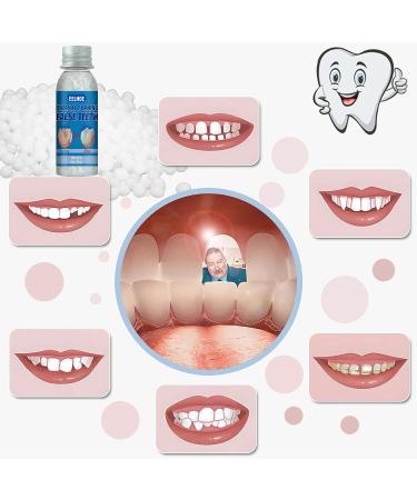 Temporary Tooth Repair Kit | DIY Fake Teeth Replacement Dentures - 30ml Bottle - Buy Online on GoSupps.com