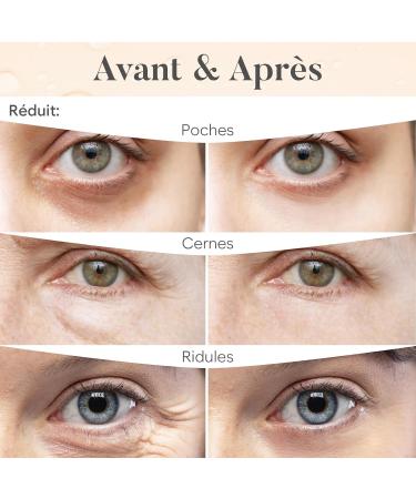 Patch Yeux Anti Cernes (20 paires) Masque Yeux avec Niacinamide et Acide Hyaluronique Anti Cernes et Poches - Caf ine Eye Patch Caffeine - Buy Online on GoSupps.com