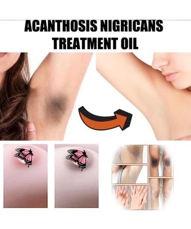 Purer Feminine Intimate Whitening Pinkish Essence 30ml - Skin Lightening Cream (3pcs) - Buy Online on GoSupps.com