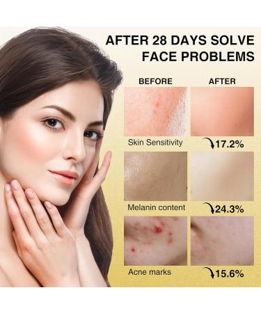 Zupora Red Light Therapy Mask - LED Face Rejuvenation & Skin Care | Red & Blue Light Therapy for Glowing Skin - Buy Online on GoSupps.com