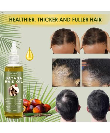 Dr. Sebi 2-in-1 Batana Oil for Hair Growth & Skin | Hair Repair Oil Set with Avocado & Sweet Almond Oil | Body Butter Included | International Shipping - Buy Online on GoSupps.com