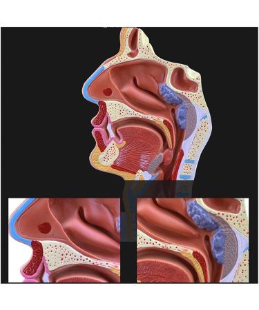 Mouth Nose Throat Pharynx Education Human Body ENT Model Study Model Pathology Nose Throat Model Enlarge The ical Model A+a - Buy Online on GoSupps.com