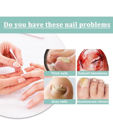 5pc 20mL Nail Women Man Nail Cuticle Puckery Nail Care Nutrition Moisturizing Nail Care Pens Cordless Drill Sanding Attachment (White One Size) 1 ml (Pack of 1) White - Buy Online on GoSupps.com