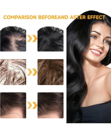  MagiSel Anti Hair Loss Lotion Men Women 30ml Essence for Hair Growth Fast Growth Hair Treatment Hair Growth Serum Anti Hair Loss for Women - Buy Online on GoSupps.com