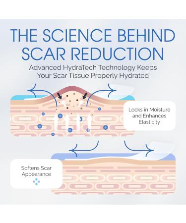 Medical Grade Silicone Scar Sheets - 3 Water-Resistant Strips & 8 Breathable Gel Sheets for Surgical Scars - International Shipping Available - Buy Online on GoSupps.com