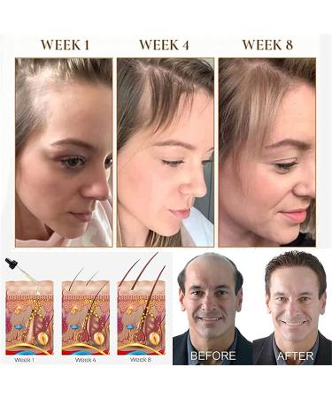 Puraect Fermented Rice Water Serum for Hair Growth - Biotin Hair Loss Solution | Thinning Hair Treatment (1 PC) - Buy Online on GoSupps.com