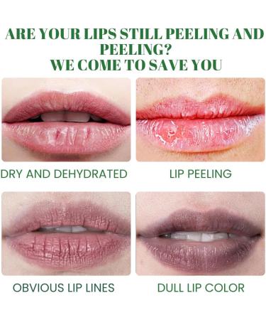 Lip Balm | Lip Lightening For Dark Lips | Organic Lip Lightening Balm | Nourishing Lip Bleaching Cream Care Repair & Protection - Buy Online on GoSupps.com