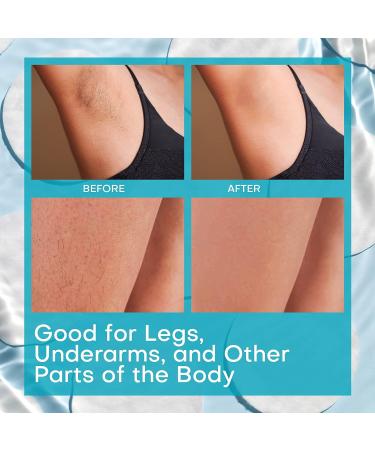 Ingrown Hair Treatment Pads 50 Count - Topical Daily Treatment for Razor Burn, Bumps, After Shave, Waxing - Bikini Bump Blaster, Prevents Ingrown Hairs, Soothes Irritation - Buy Online on GoSupps.com