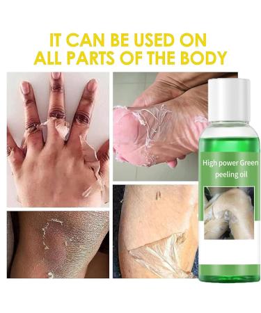 Dark Skin Exfoliating Oil Extra Strong Green for Hands Feet and Whole Body for at-home facial chemical exfoliation (220 ml/7.76 oz) - Buy Online on GoSupps.com