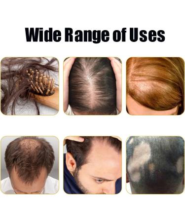  homomdy Lidoria 7 Day Ginger Hair Loss Oil Hair Growth Oil Anti Hair Loss Serum Natural Ginger Hair Growth Germ Serum (2PCS) - Buy Online on GoSupps.com