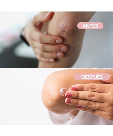  ALBA NATURA Alba Natura - Restorative butter for dry or chapped skin - Moisturizing balm with shea butter and donkey milk - Regenerating effect - Aluminium jar 30 ml - Buy Online on GoSupps.com