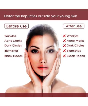 NUTRIGLOW 5 In 1 Face Massager Wine Facial Kit - Enhance Your Skincare Routine | 250g + 10g | International Shipping Available - Buy Online on GoSupps.com